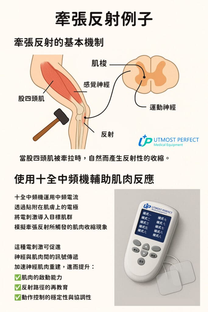 牽張反射肌肉原理與中頻機作用